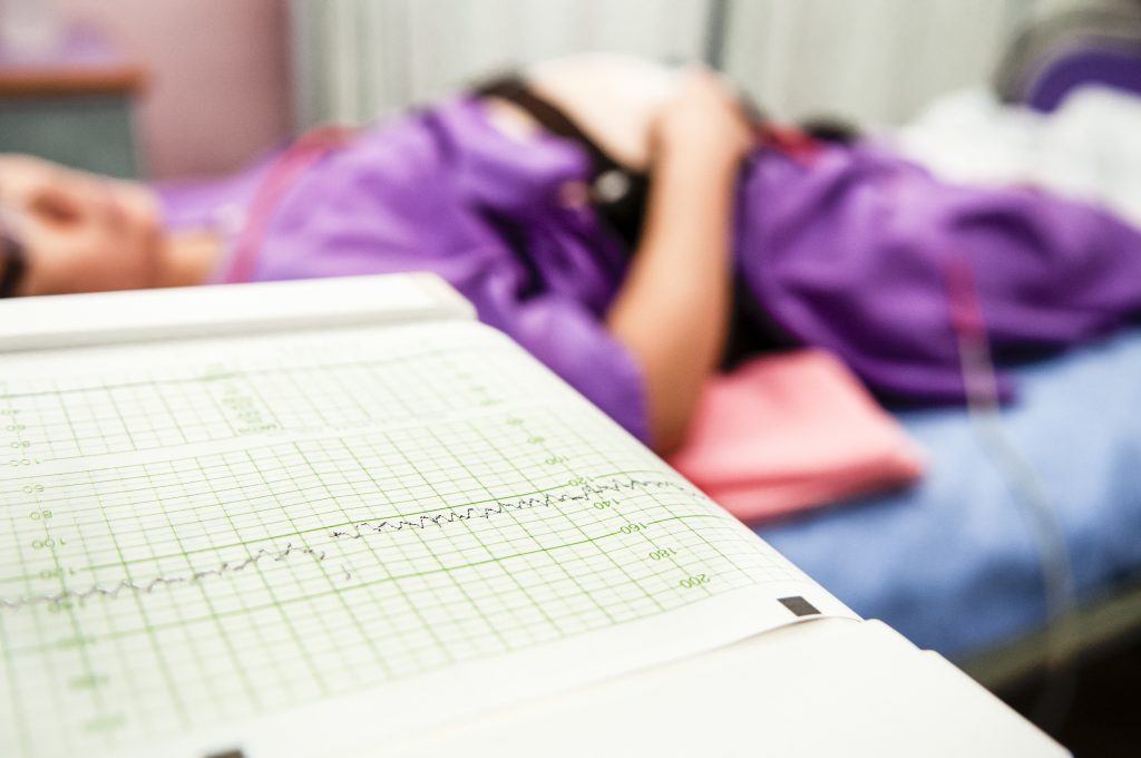 A pregnant person lies on a hospital bed with a fetal heart monitor printout in the foreground, highlighting the connection between physical and mental health during pregnancy.